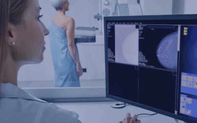 Mammographie : examen clé dans la lutte contre le cancer du sein