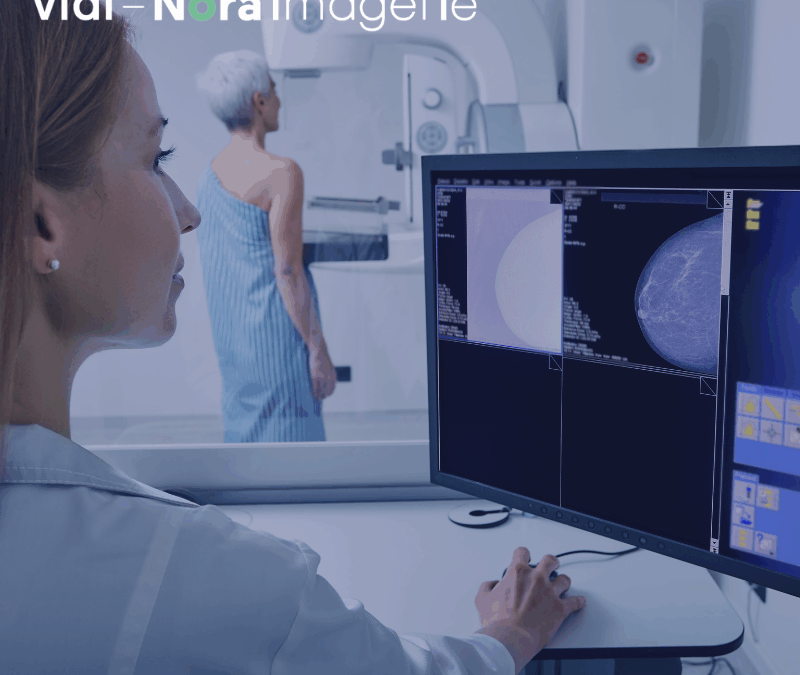 Mammographie : examen clé dans la lutte contre le cancer du sein