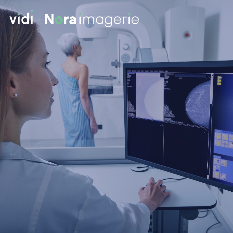 La mammographie – NI